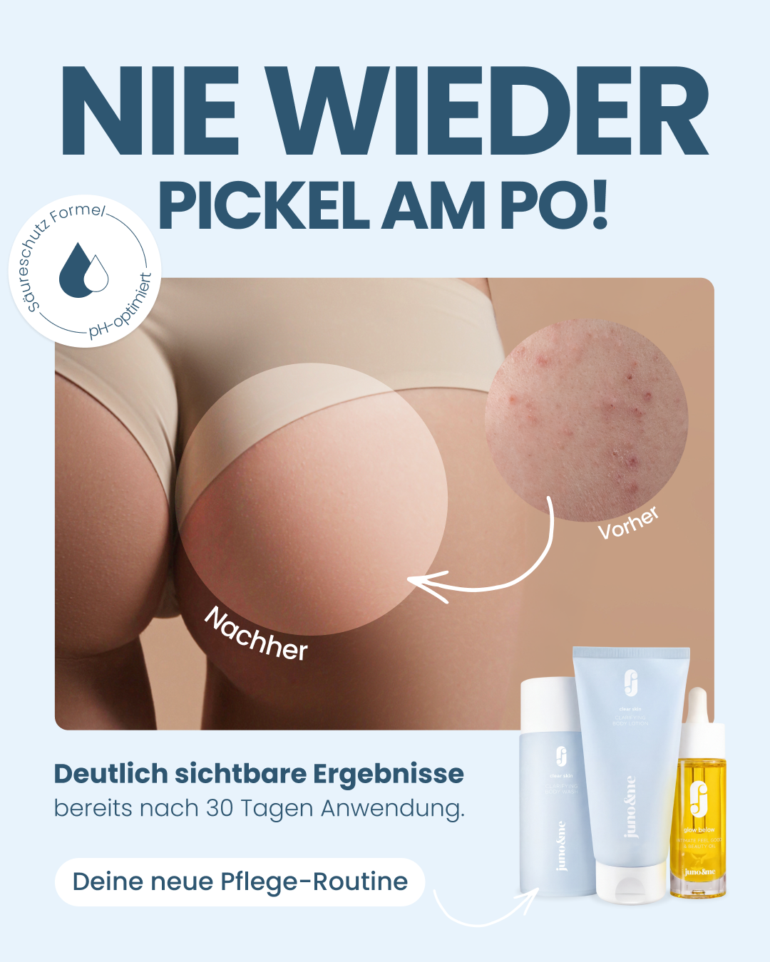 Bye Bye Pickel Set