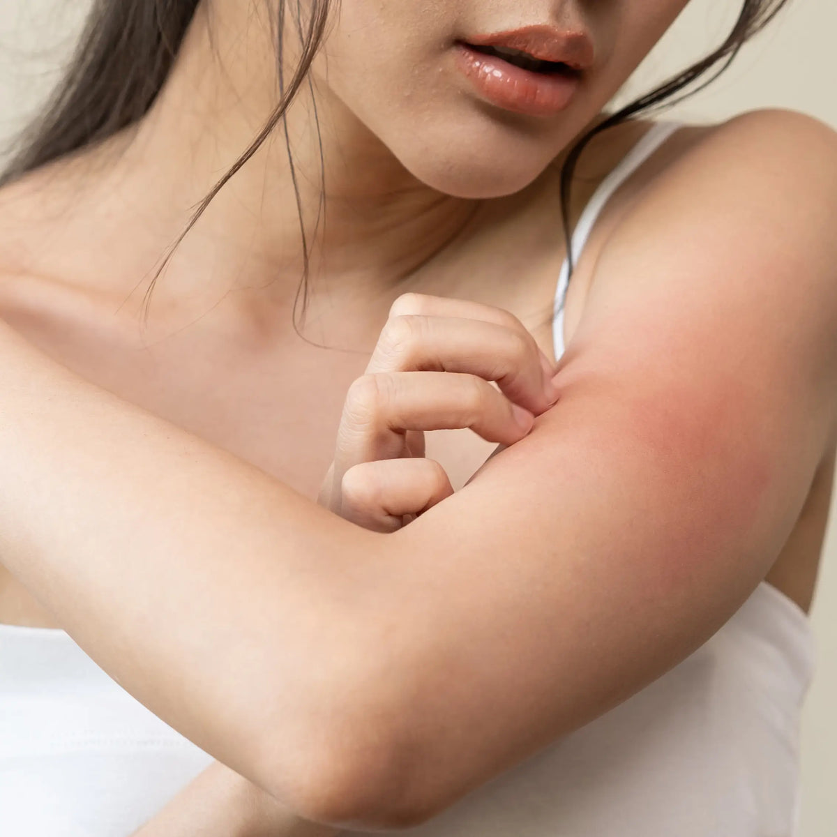 Skin irritation caused by stress